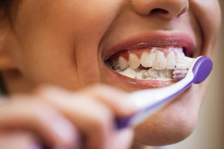6 errores comunes de higiene bucal